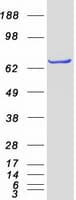 Human FARSB Protein (Recombinant Myc-DDK (Flag))