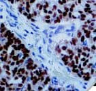 Estrogen Receptor Antibody (Ready-to-Use)