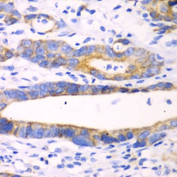 Polyclonal Rabbit anti-Human CHIA / Amcase Antibody (IHC, WB)