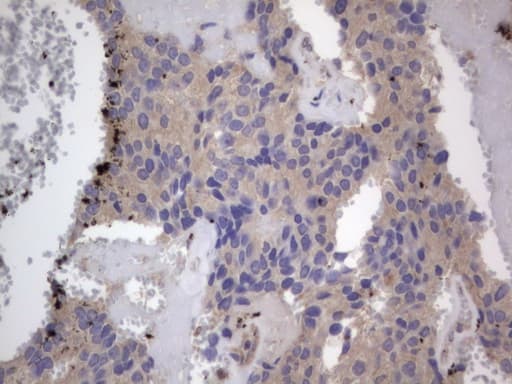 Monoclonal Mouse anti-Human SMPD1 / Acid Sphingomyelinase Antibody (clone OTI3H7, aa62-341, IHC, WB)