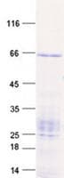 Human IL12RB1 / CD212 Protein (Recombinant GST, N-terminus + His, C-terminus)