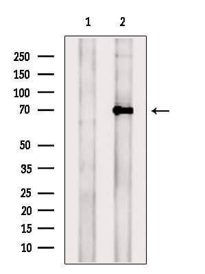 TRPV6 Antibody