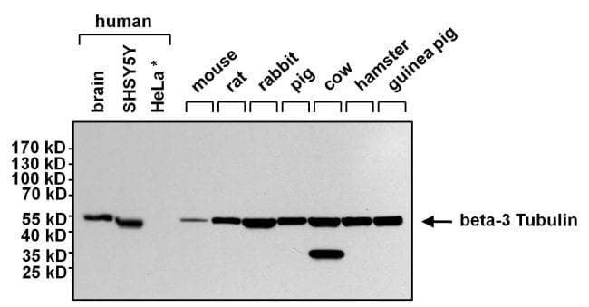 Goat Anti-Mouse IgG Secondary Antibody (HRP)