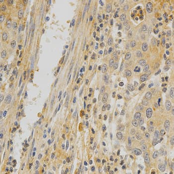 OPG / Osteoprotegerin Antibody