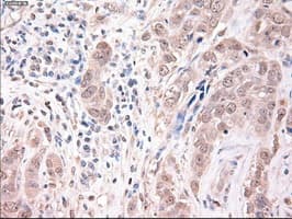 TRIM33 / TIF1-Gamma Antibody (clone OTI6B7)