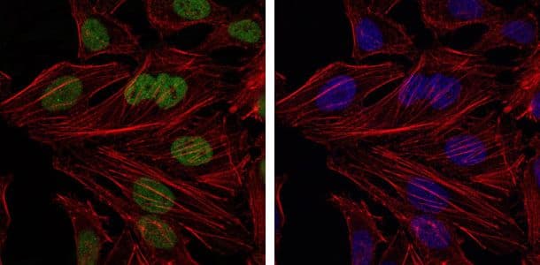 BMI1 / PCGF4 Antibody (clone 3000)