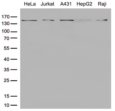 SMC1A / SMC1 Antibody (aa889-1016, clone OTI5C8)