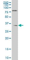 NKX6-1 Antibody (clone 1B7)