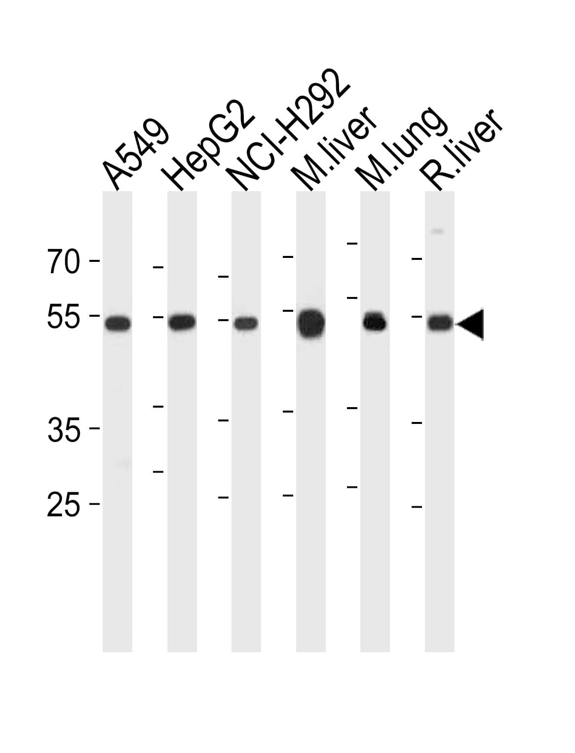 IHC-plus™ Polyclonal Rabbit anti-Human ALDH2 Antibody (aa52-81, IHC, IF, WB)