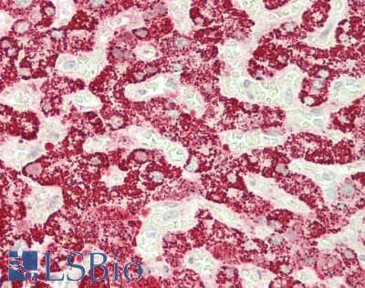 IHC-plus™ ABAT Antibody