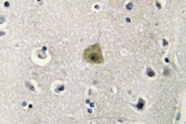 Polyclonal Rabbit anti-Human MAP2K1 / MKK1 / MEK1 Antibody (Pro293, IHC, WB)