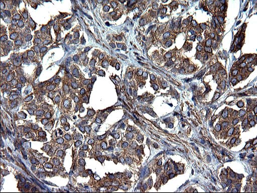 TUBA1A / Tubulin Alpha 1a Antibody (clone OTI2C8)