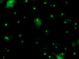 Monoclonal Mouse anti-Human PGAM2 Antibody (clone OTI4H1, IF, WB)