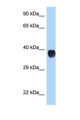 Polyclonal Rabbit anti-Human RHD Antibody (N-Terminus, WB)