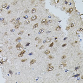 TRPC3 Antibody