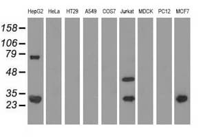 QPRT Antibody (clone OTI4B4)
