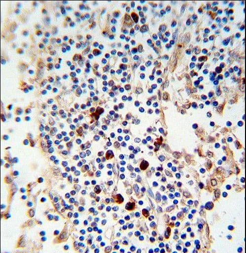 Mouse Anti-Human Kappa Light Chain Secondary Antibody