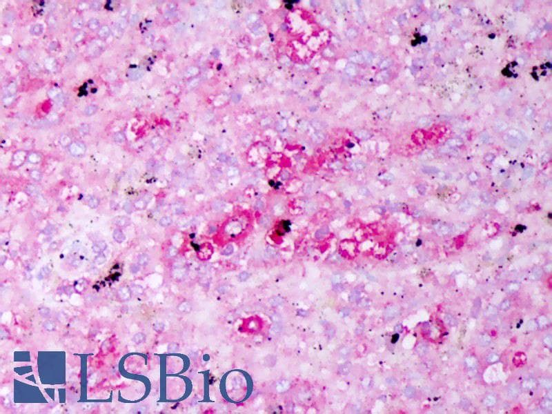 IHC-plus™ IL-10 Antibody