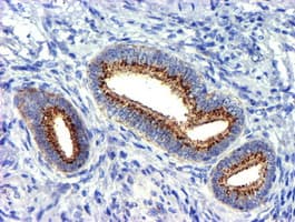 GOLM1 / GP73 / GOLPH2 Antibody (clone OTI5F4)