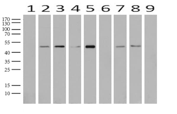 Monoclonal Mouse anti-Human ABAT Antibody (clone UMAB179, aa29-323, IHC, IF, WB)