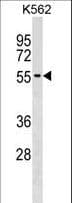 Polyclonal Rabbit anti-Human UTP3 / CRLZ1 Antibody (aa416-444, WB)