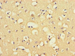 MAP3K8 / TPL2 Antibody
