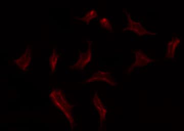 LGALS3 / Galectin 3 Antibody