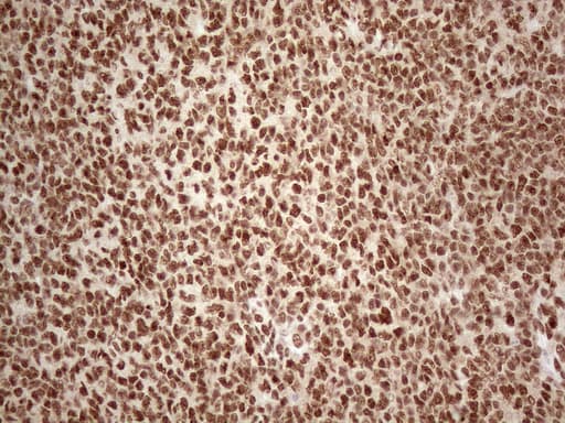 IRS1 Antibody (aa1-280, clone OTI3G10)