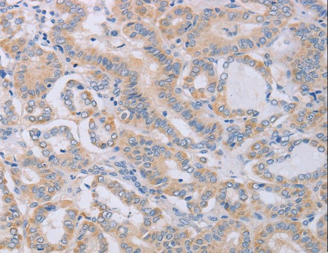 Polyclonal Rabbit anti-Human Osteocalcin Antibody (IHC)