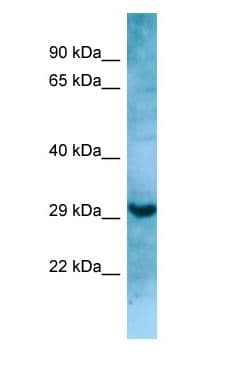 Polyclonal Rabbit anti-Human MASP1 / MASP Antibody (aa110-159, WB)