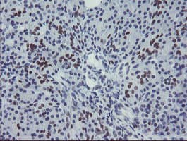 MEIS3 Antibody (aa1-261, clone OTI1B2)