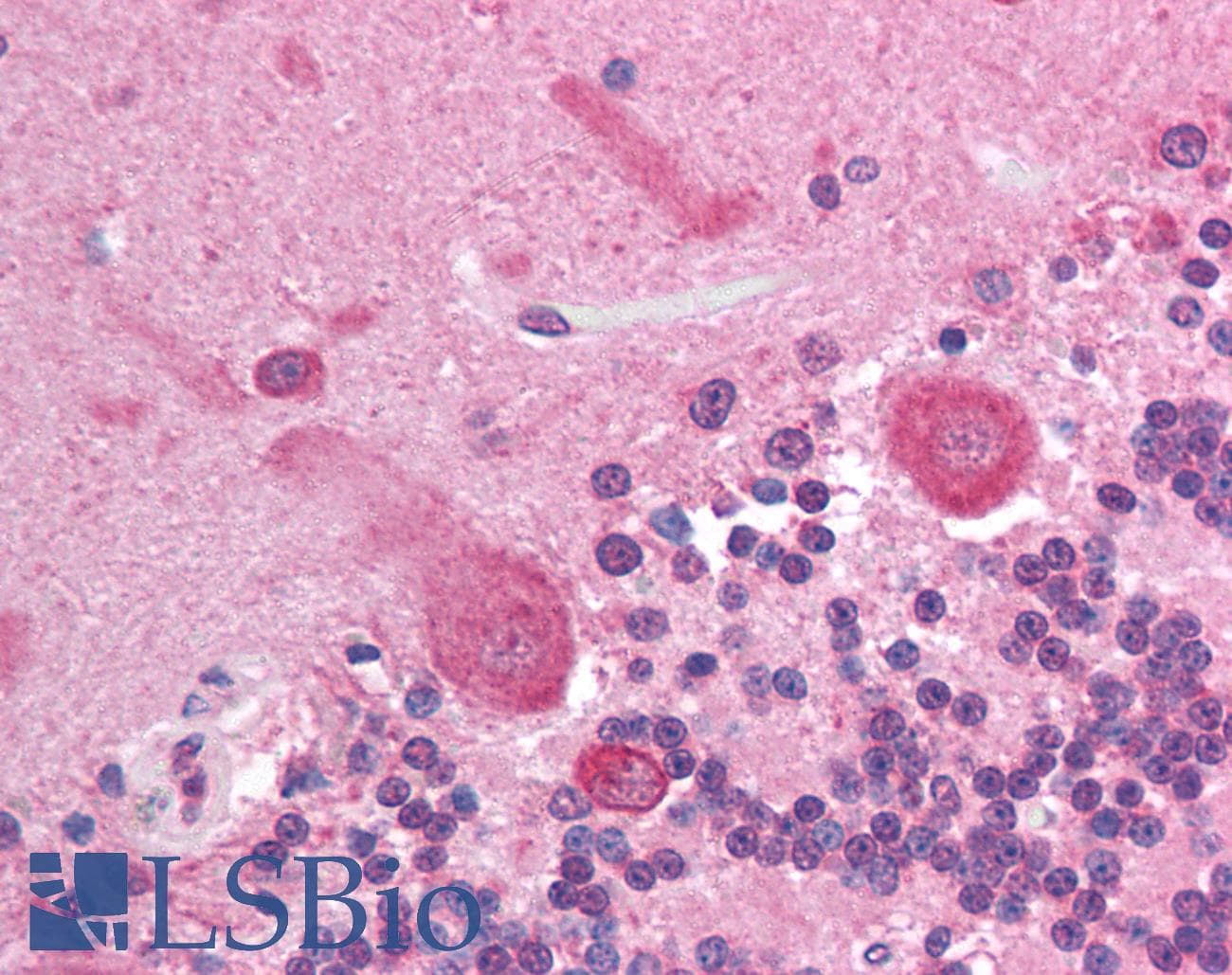 IHC-plus™ Monoclonal Mouse anti-Human AKT3 Antibody (clone 66C1247.1, aa119-136, IHC, WB)