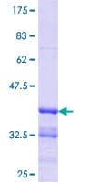 Human ZBTB7B / HcKrox Protein (Recombinant GST, N-terminus)
