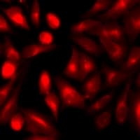 ARRB2 / Beta Arrestin 2 Antibody