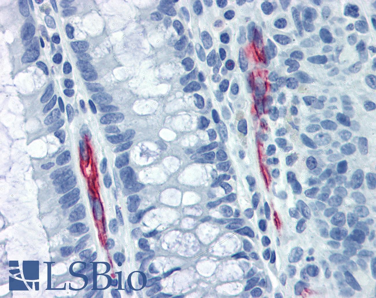IHC-plus™ Monoclonal Mouse anti-Human MAdCAM-1 Antibody (clone 314G8, Low Endotoxin, IHC)