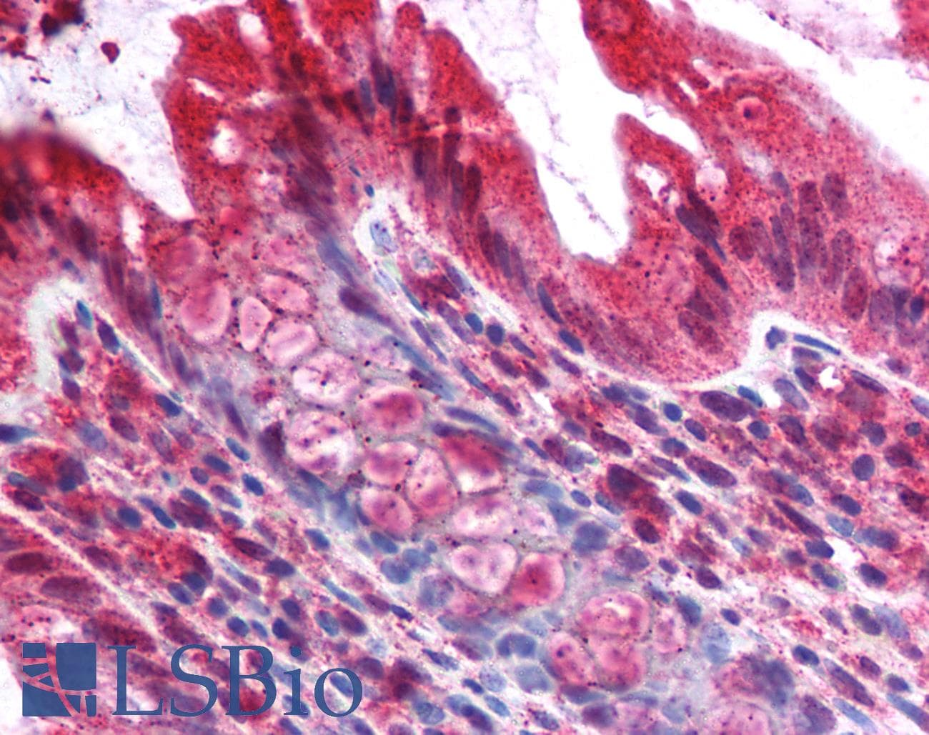 IHC-plus™ Polyclonal Rabbit anti-Human BBC3 / PUMA Antibody (IHC)