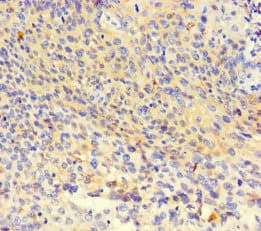 NR1H3 / LXR Alpha Antibody