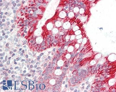 PathPlus™ IGFBP3 Antibody (aa130-179)