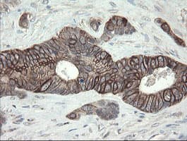DPH2 Antibody (clone OTI2B12)