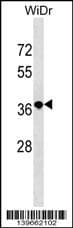 TIF-IA / RRN3 Antibody (aa 286-312, C-term)