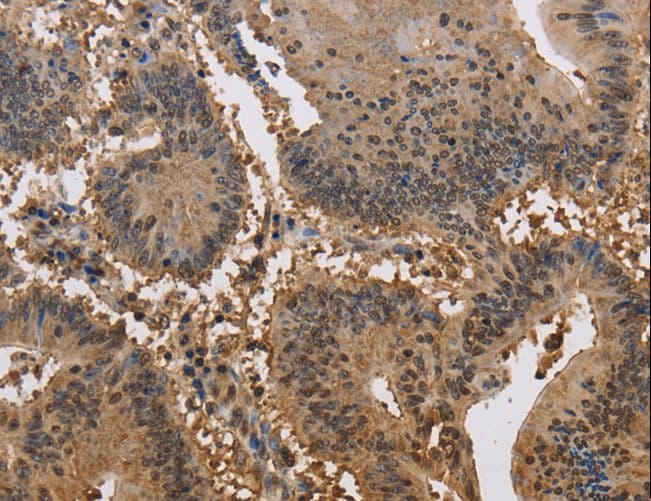 JAG2 / Jagged-2 Antibody