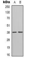 INHBE / Activin Antibody (C-Terminus)