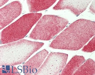 IHC-plus™ SKIL / SNO / SnoN Antibody (clone 2F6)