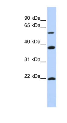 Polyclonal Rabbit anti-Human MYLIP / IDOL Antibody (aa360-409, WB)