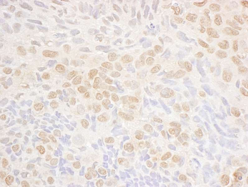 Polyclonal Rabbit anti-Human DRAK1 / STK17A Antibody (aa354-414, IHC, WB)