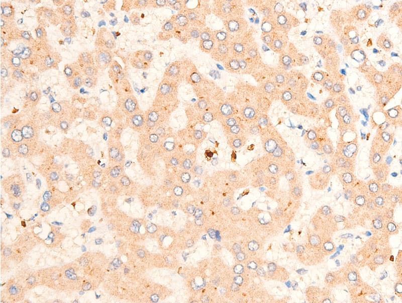 TGFB1 / TGF Beta 1 Antibody