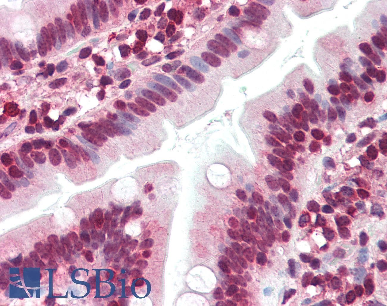 IHC-plus™ ZNF292 Antibody