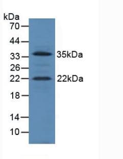IGF1 Antibody (aa49-153)
