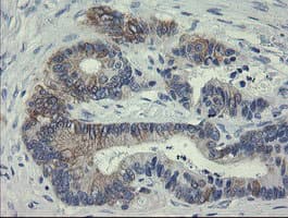 Monoclonal Mouse anti-Human SLA2 / SLAP2 Antibody (clone OTI1D8, IHC, WB)