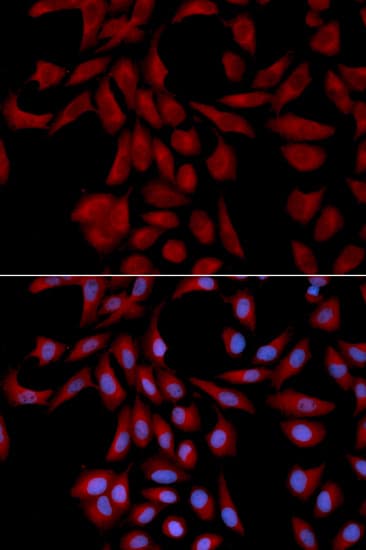 IHC-plus™ UBE2I / UBC9 Antibody